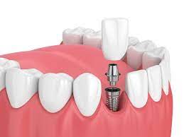 dental