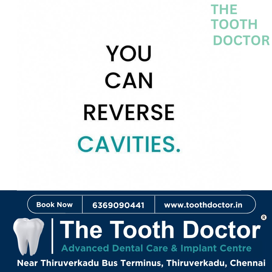 Reverse Cavities